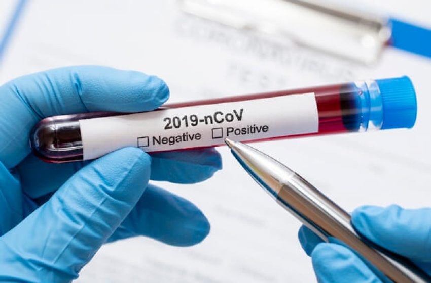  Országos tisztifőorvos: új szakaszába ért a járvány, jönnek a csoportos megbetegedések